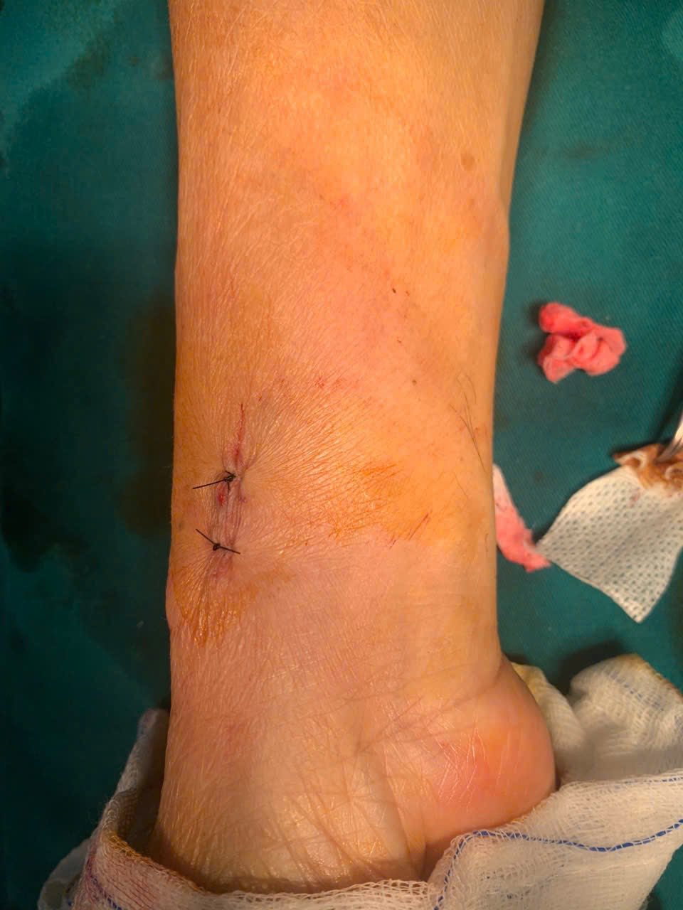 /images/companies/benhvienducgiang/images/2026/tháng 3/653082884_962488022783780_2619856389685296225_n.jpg